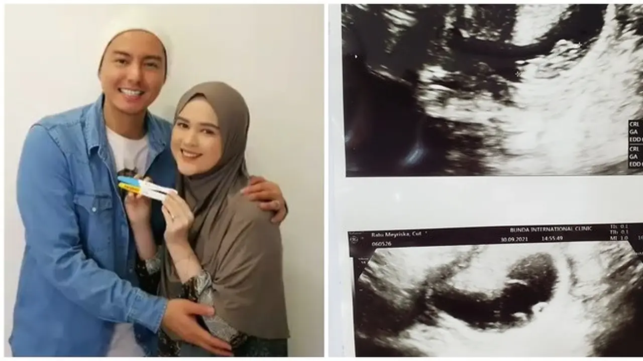 Umumkan Hamil Anak Kedua, Ini 6 Potret Keluarga Kecil Cut Meyriska dan Roger Danuarta