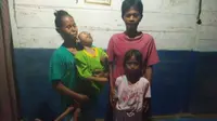 Selama 15 tahun, sang ibunda, Siti Suntari, merawat Candra yang mengalami lumpuh. Namun, kini Siti telah meninggal. (Liputan6.com/Ahmad Adirin)