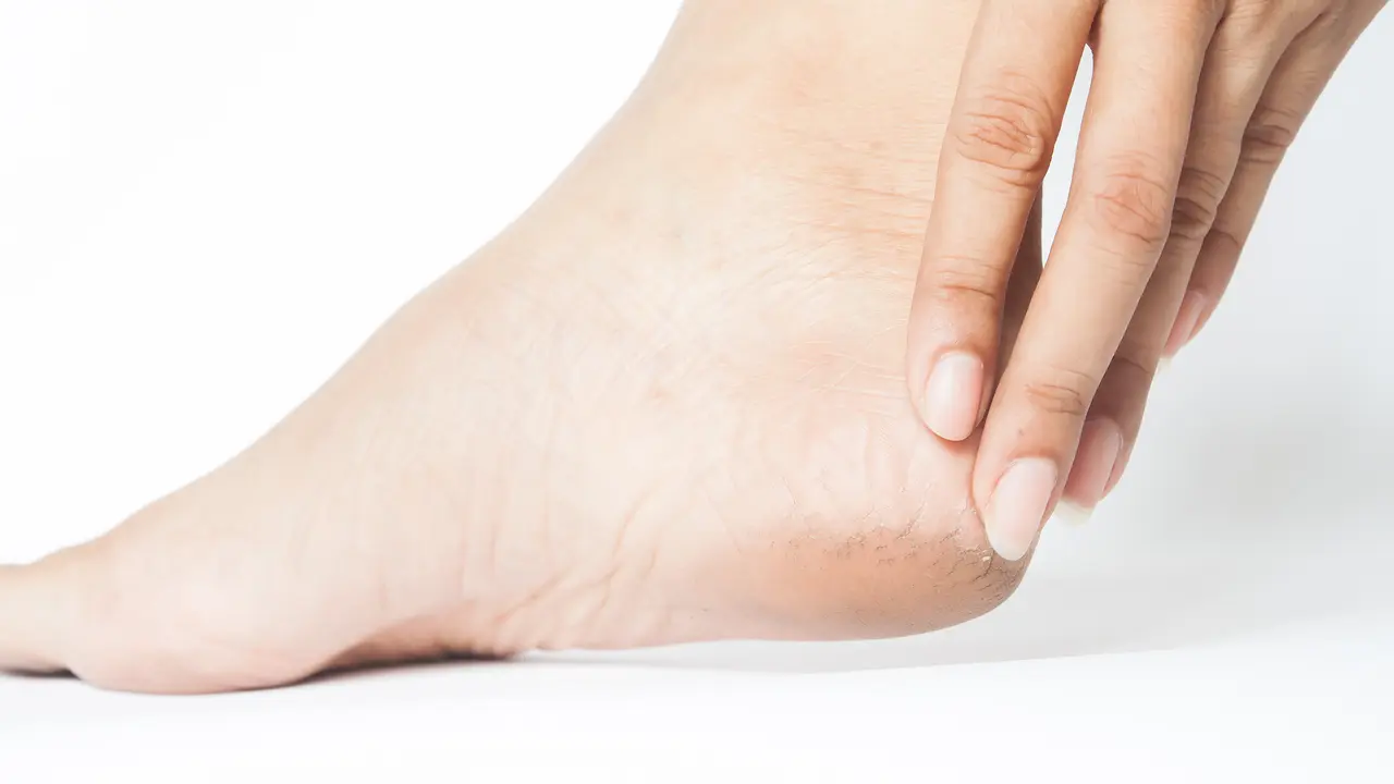 Perawatan kaki pecah-pecah dengan produk dan rutinitas sederhana