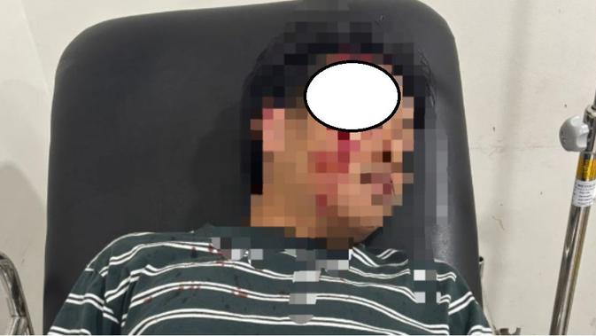 Anak Purnawirawan Polri Hajar Pegawai Bank, Dipicu Masalah Speaker