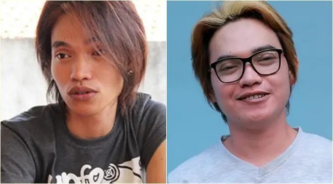 Perubahan Dodhy Kangen Band (Instagram/dodhyofficial)