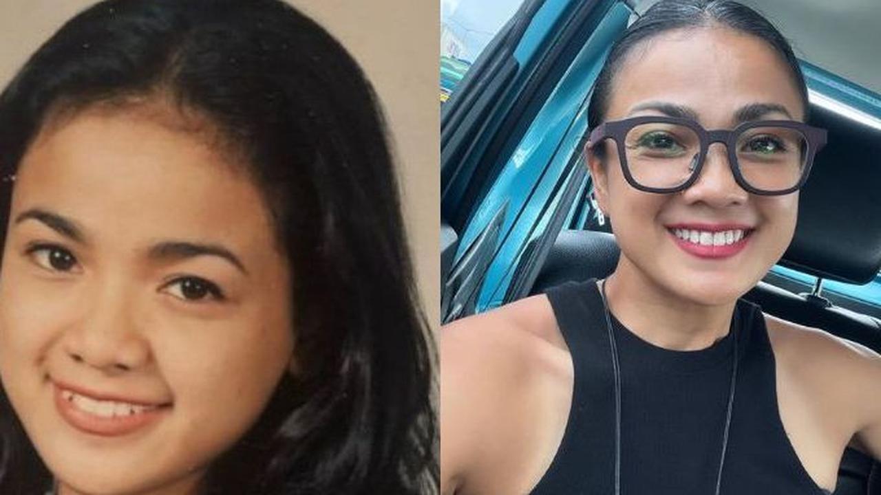 Nirina Zubir memiliki gigi gingsul saat remaja.&nbsp;