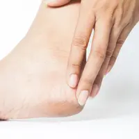 Tips Mengatasi Kaki Pecah-Pecah agar Kembali Halus