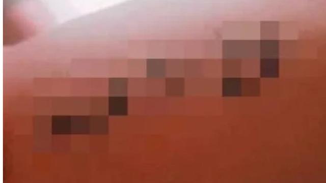 Bikin Tato dengan Nama Pacar, Seminggu Kemudian Pasangan Ini Malah Putus