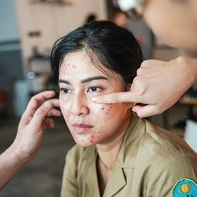 Demi Film Ini 7 Potret Dian Sastro Tampil Jerawatan yang Curi Perhatian