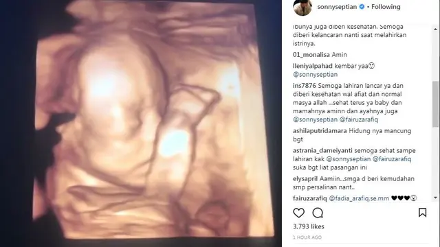 Calon Bayi Fairuz A Rafiq
