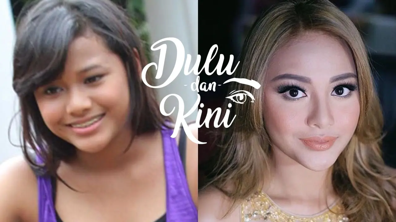 Dulu dan Kini: Dari Chubby Hingga Tirus, Transformasi Aurel Hermansyah Bikin Pangling