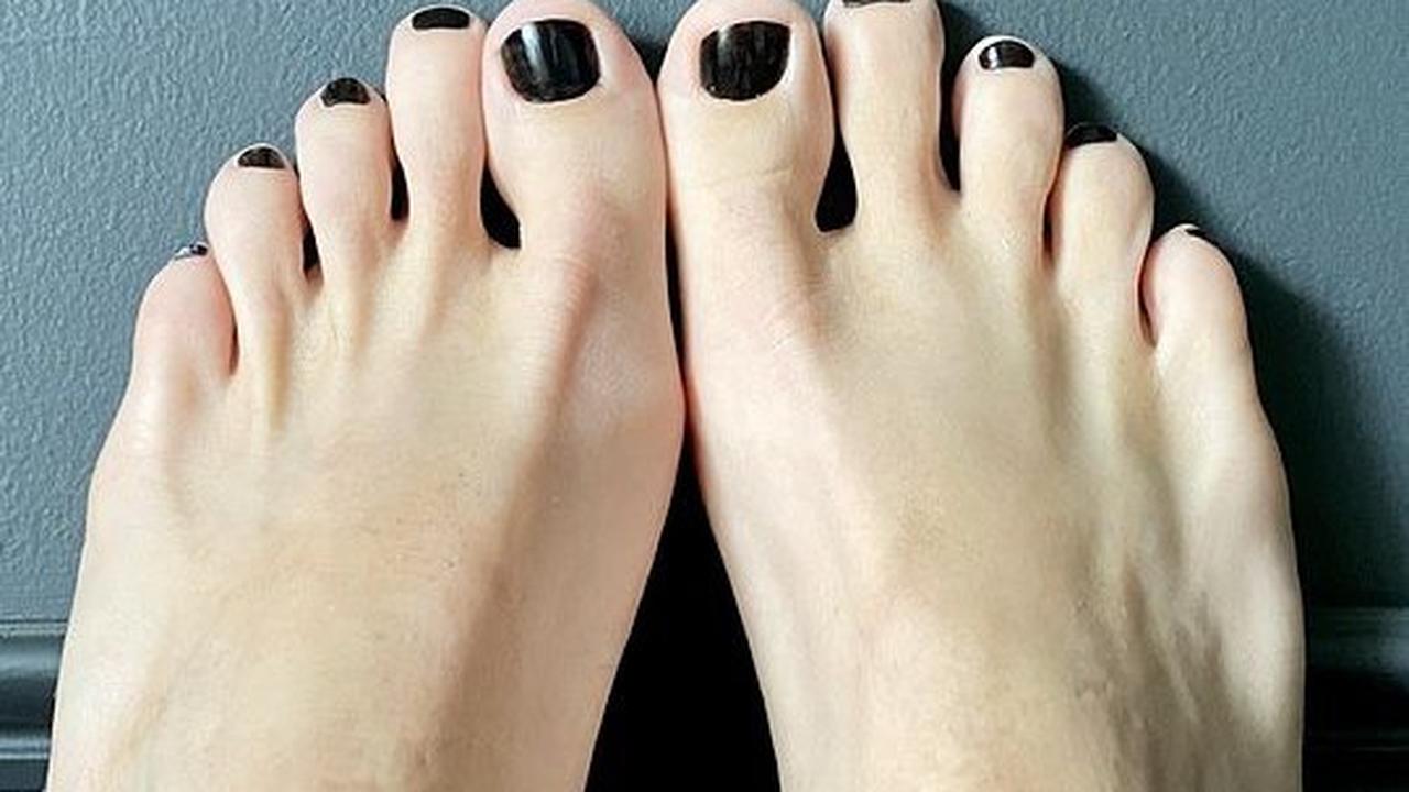 Penyebab Kuku Kaki Hitam, Ketahui Cara Mengobatinya