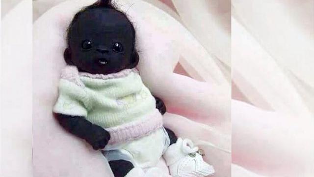 Bayi Berkulit Paling Legam Ini Gegerkan Publik Di Socmed Citizen6 Liputan6 Com