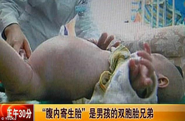 Xiao Feng divonis hamil setelah diperiksa dengan sinar X dan MRI (c) dailymail.co.uk