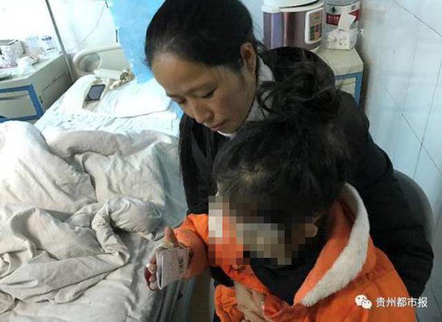 Wajah anak 5 tahun rusak parah setelah ponsel orang tuanya meledak | Photo: Copyright shanghaiist.com