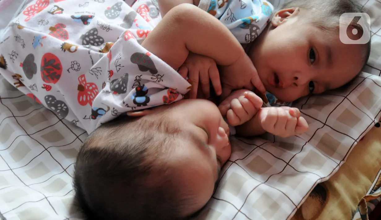 Bayi kembar siam Queenetha Zaina dan Queenesha Zahira di rumahnya di Perumahan Permata Indah Blok W No. 18 RT 18/03, Desa Bojongraharja, Kabupaten Sukabumi, Sabtu (14/08/2021). Bayi kembar siam berusia 1,5 bulan ini memiliki dua jantung dan satu hati. (merdeka.com/Arie Basuki)