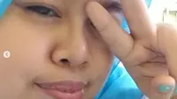 Kekeyi mendapat banyak pujian dari warganet usai menjalani operasi hidung sehingga lebih mancung (dok.Instagram/@rahmawatikekeyiputricantikka23/https://www.instagram.com/p/CPk5WzsnJTx/Komarudin)