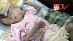 Berat tubuh Mutiara, bayi berusia satu tahun enam bulan ini tak seimbang dibanding bayi seusianya. Demam sang bayi masih tinggi mencapai 38 derajat Celcius. 