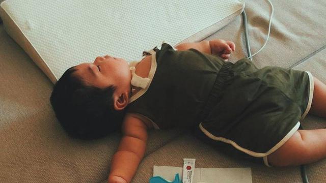 Hiro, anak dengan kondisi langka Moebius Syndrome (Foto: Tangkapan Layar Instagram @aku.superhiro)