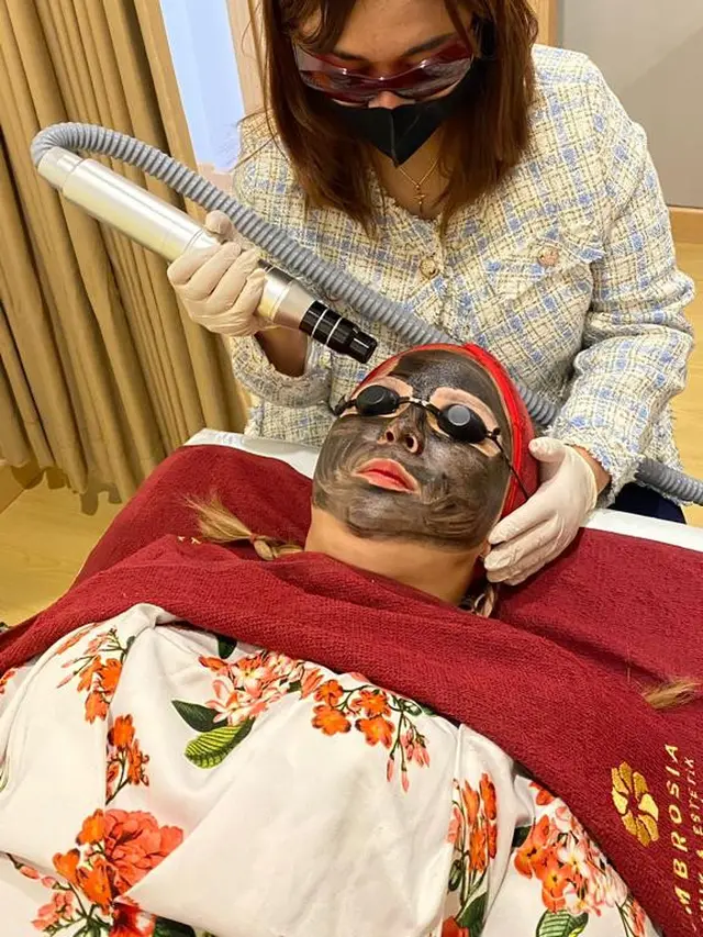 Cara Ampuh Menghilangkan Flek Hitam dengan Laser Wajah