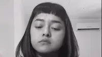 Lizzie Parra Ungkap Idap Kanker, Merasa Hidupnya Berubah dalam Hitungan Jam