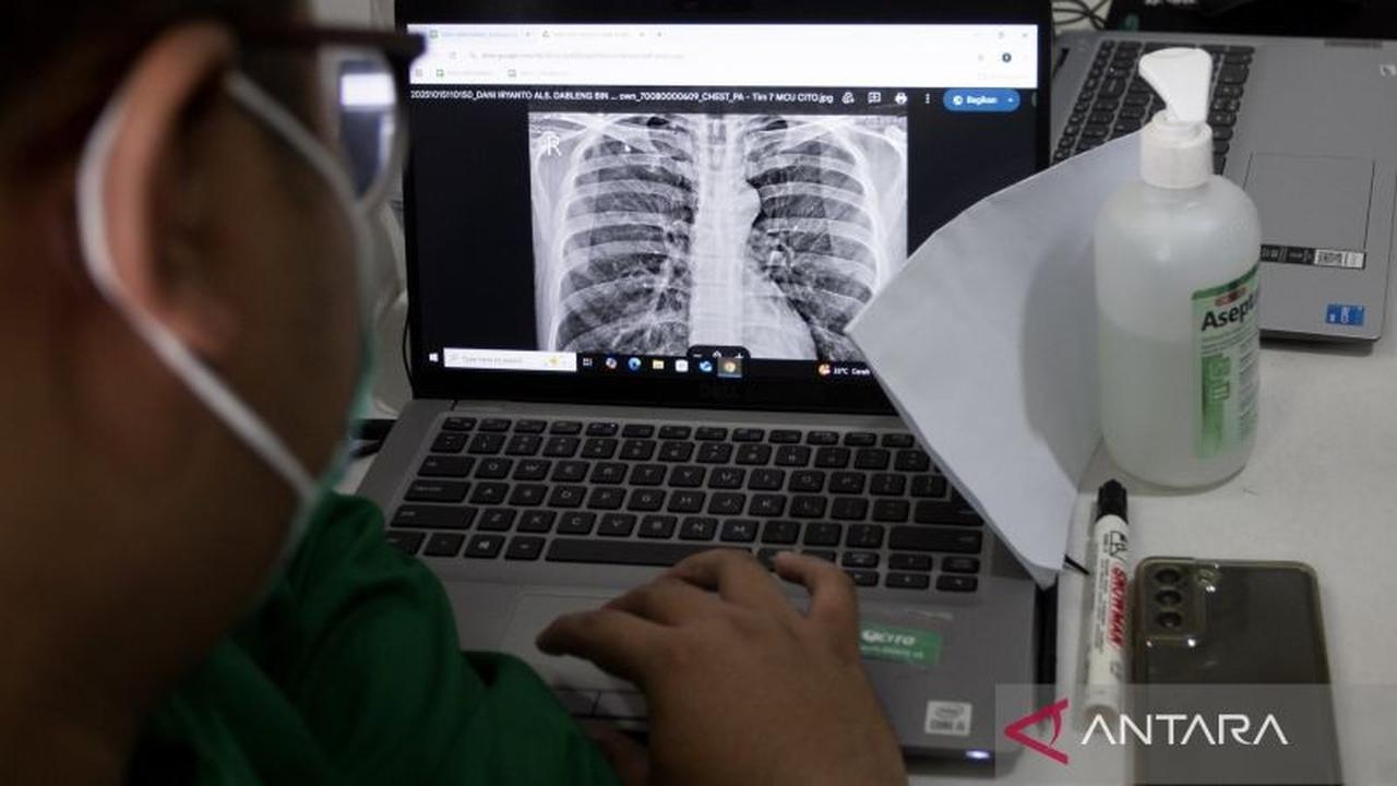 Waspada! Batuk Lama dan Berat Badan Turun Bisa Jadi Gejala Awal TBC