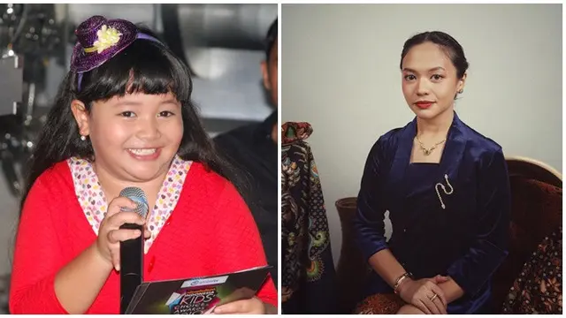 6 Potret Dulu Vs Kini Artis Cilik yang Punya Pipi Menggemaskan, Bikin Pangling