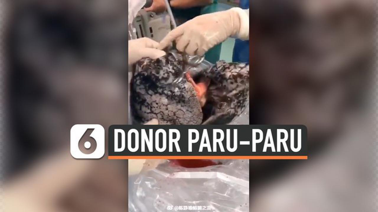 VIDEO: Paru-Paru Perokok Ditolak Rumah Sakit saat Didonorkan