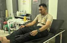Bentrok Warga Pecah di Tual Maluku, Kapolres Terluka Akibat Kena Panah saat Membubarkan Massa