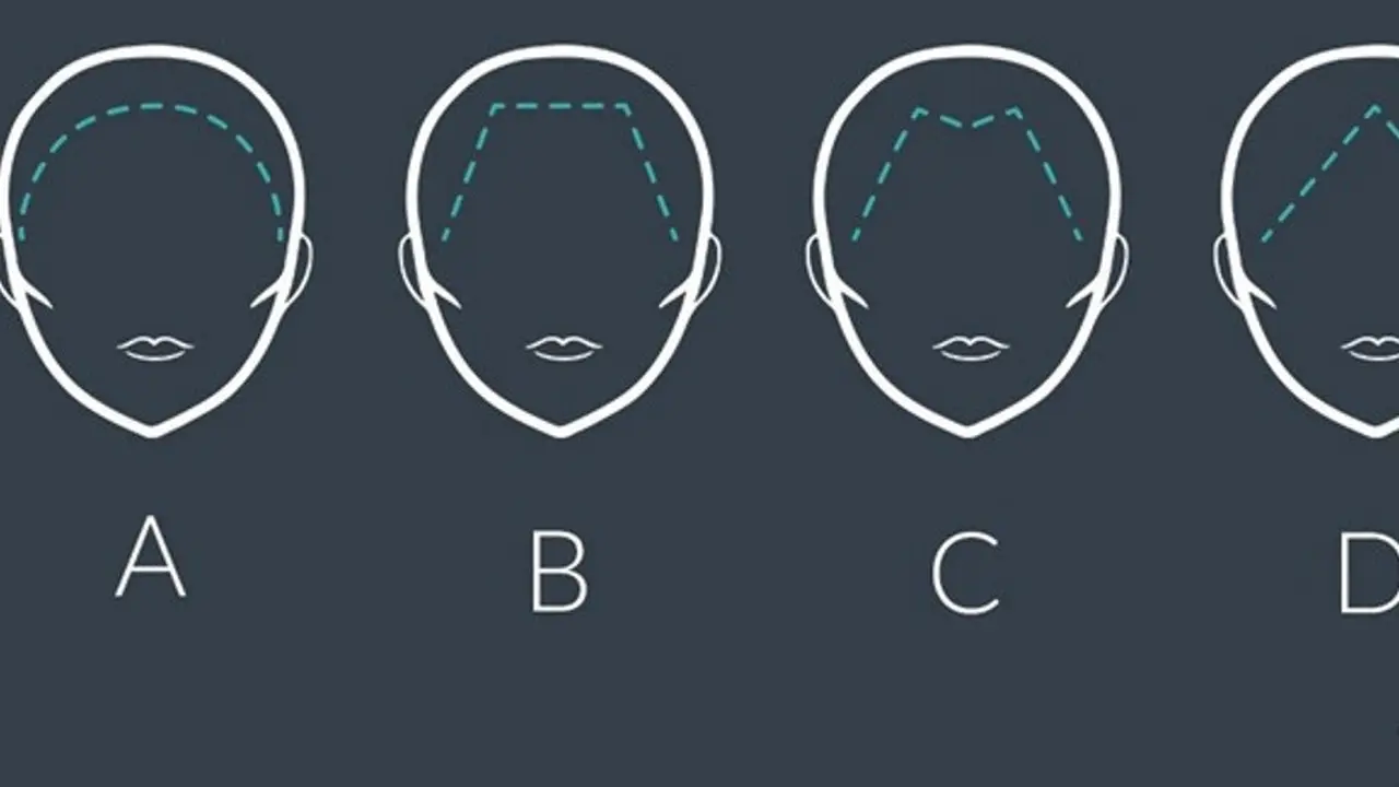 [Bintang] Garis Batas Rambut Kamu Bentuknya Kayak Gimana? Yuk, Ketahui Artinya!