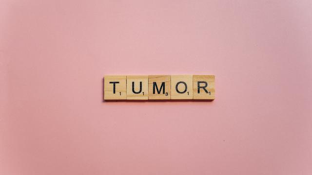 Marshanda Umumkan Idap Tumor Payudara, Kenali Penyebab dan Gejalanya Sejak Dini