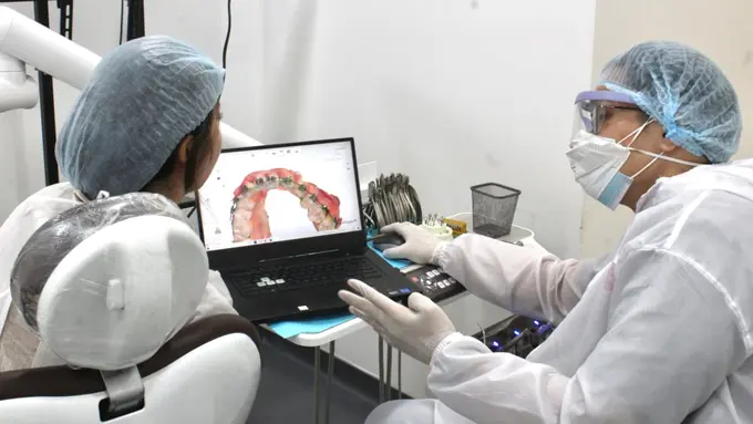 Smiley, clear aligner