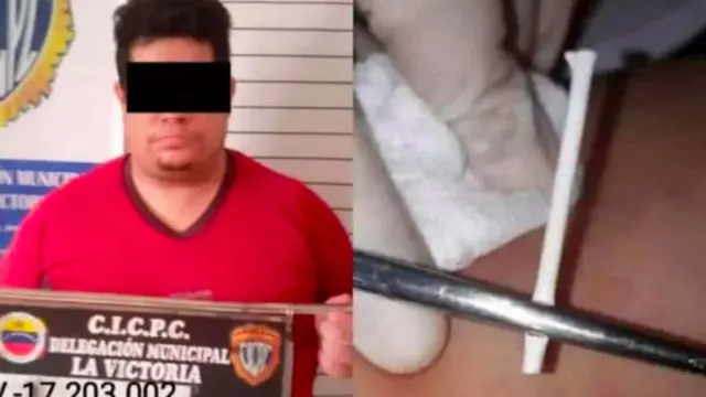Tanam Stik Lolipop Layaknya Alat Kontrasepsi, Dokter Gadungan Ditangkap