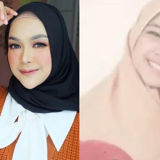 Dituding Operasi Plastik Ini 7 Potret Transformasi Ria Ricis Hot Liputan6 Com