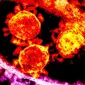 Middle East Respiratory Syndrome coronavirus (MERS-CoV) masih belum dapat dianggap sebagai ancaman global.