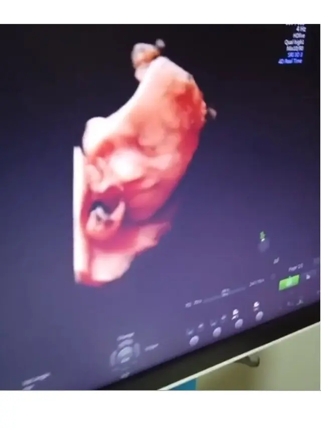 6 Pose Unik Anak Seleb saat di USG, Anak Cut Meyriska Bergaya Metal