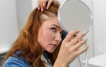 5 Kesalahan Sepele yang Bikin Rambut Rontok, Salah Satunya Cara Keramas yang Salah