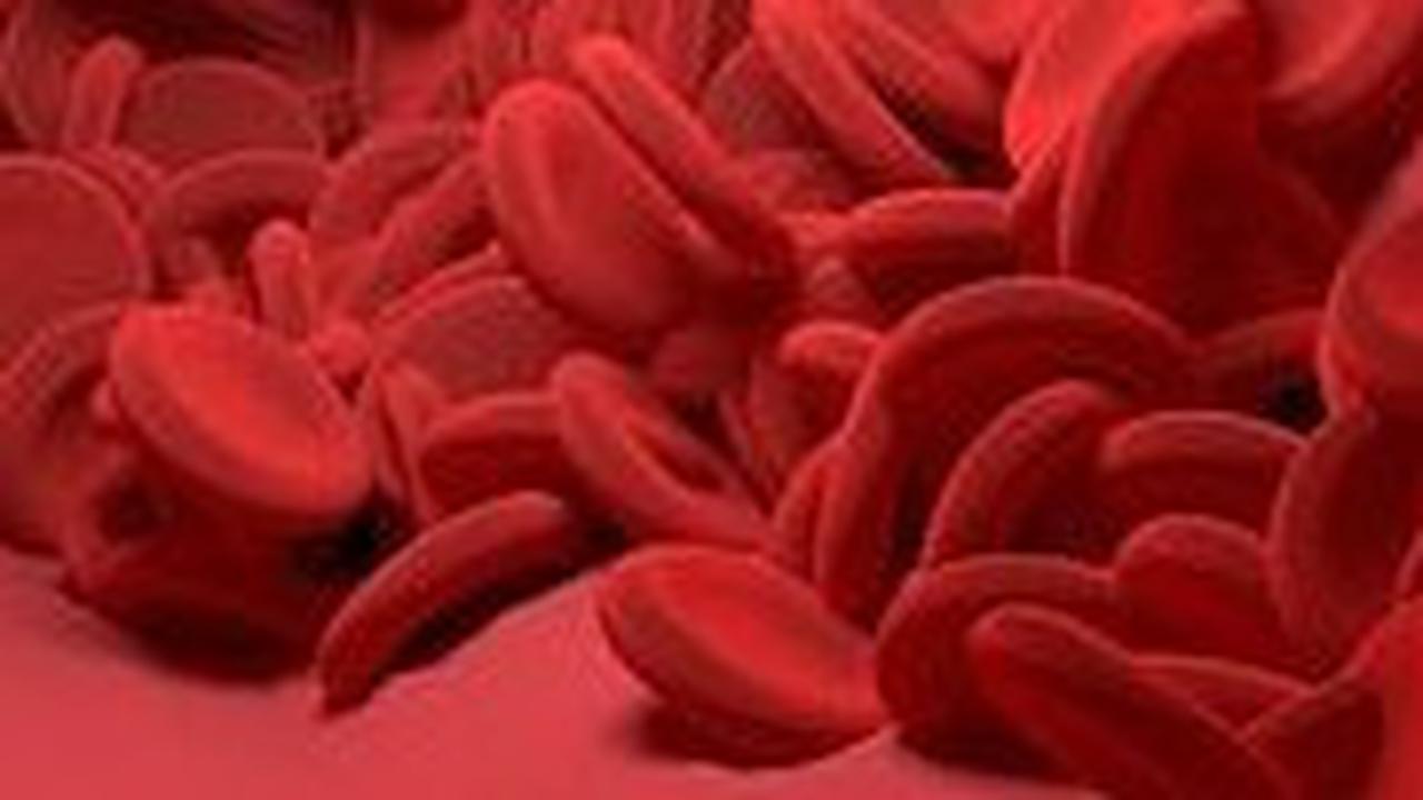 Kenali Kondisi Leukemia atau Kanker Darah yang Bisa Diderita oleh Anak