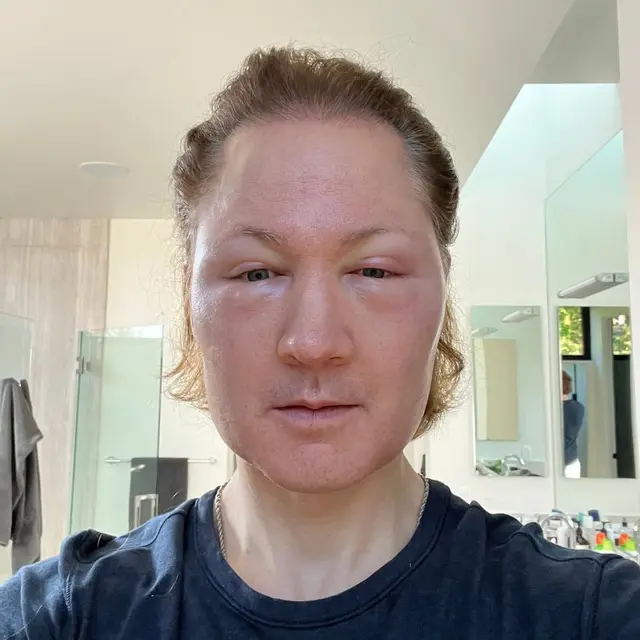 Demi punya bokong terbesar di dunia, model Serbia ini rela suntik 45 kg lemak dalam 9 tahun