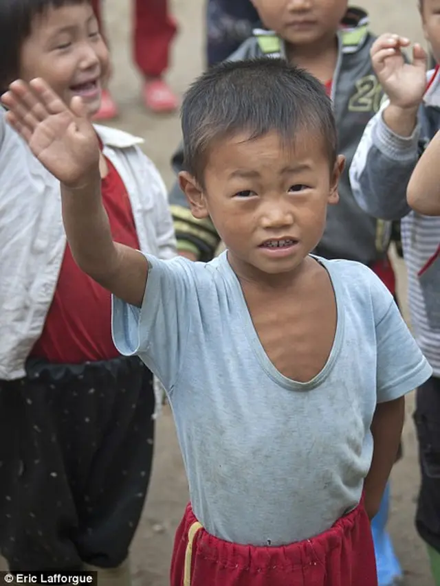 Potret Malnutrisi Pada Anak-Anak di Korea Utara.