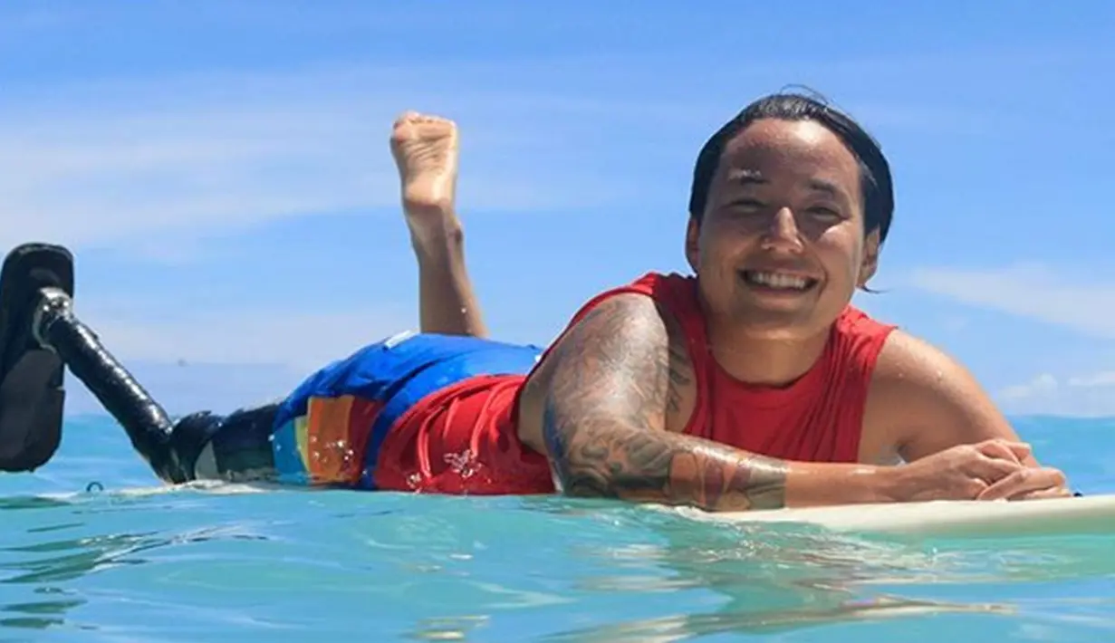 Dani Burt merupakan seorang penyandang disabilitas. Karena kecelakaan yang dialaminya, Dani harus menerima kakinya diamputasi. Bahkan, dirinya sempat koma selama 45 hari. Meski harus menggunakan kaki buatan, Dani Burt berhasil menjuarai kejuaraan selancar dunia.(Instagram/@dani.burt)