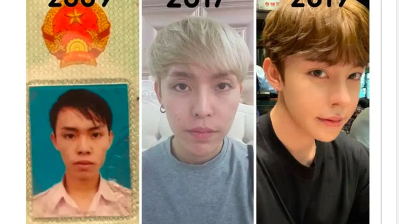Ditolak Kerja karena Kurang Ganteng, Pria Nekat Operasi Plastik hingga Mirip Idol Kpop