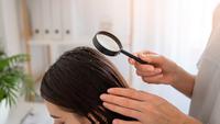 How To Get Rid Of Dandruff Fast: 12 Expert Tips for a Flake-Free Scalp