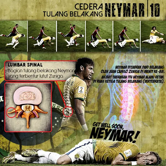 Infografis Cedera Tulang Belakang Neymar (Liputan6.com/Yoshiro)