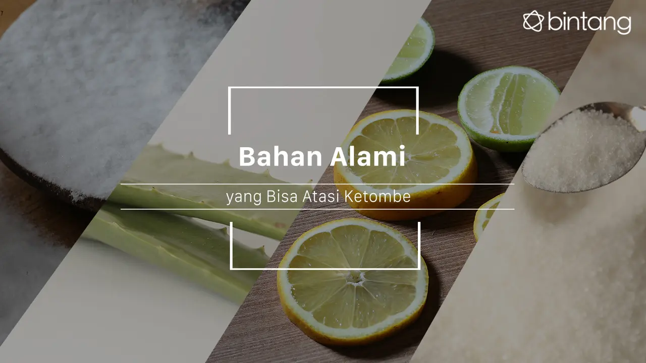 Atasi Ketombe dengan 5 Cara Ini, Dijamin Hilang!