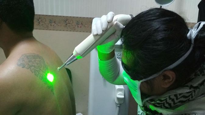 Syarat Unik Hapus Tato Gratis di Cirebon - Regional Liputan6.com