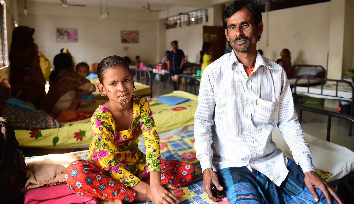 Sahana Khatun ditemani ayahnya, Mohammad Shahjahan, saat menjalani perawatan di sebuah rumah sakit di Dhaka, Bangladesh, 30 Januari 2017. Dokter menyimpulkan, Sahana mengalami kelainan yang sama langkanya dengan empat orang lain di seluruh dunia (STR/AFP)