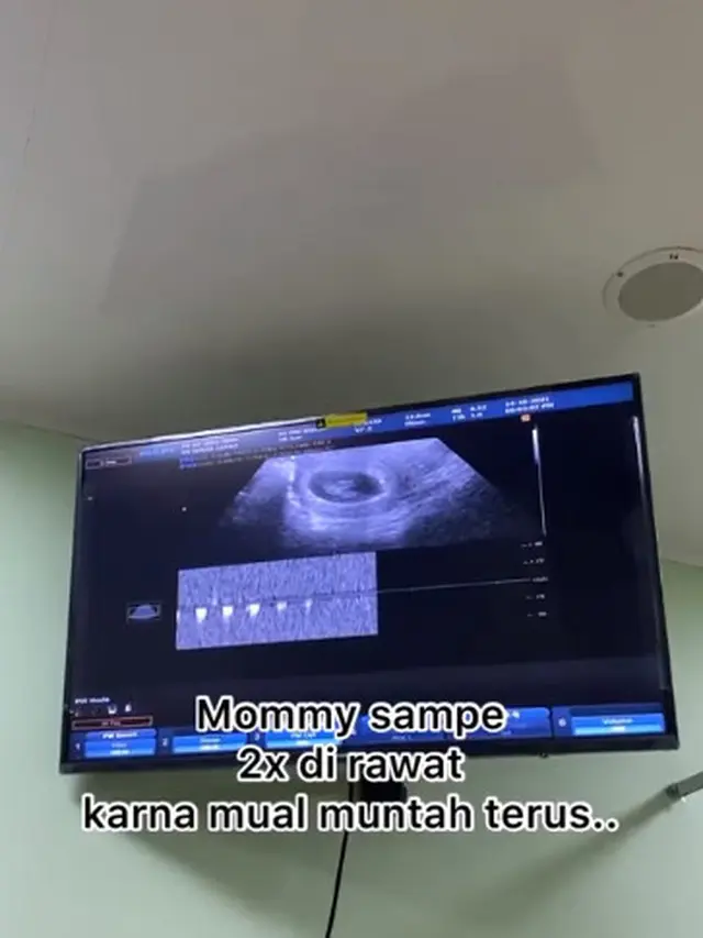 Dikaruniai Bayi Perempuan, Ini 6 Potret Perjalanan Kehamilan Istri Ikbal Fauzi