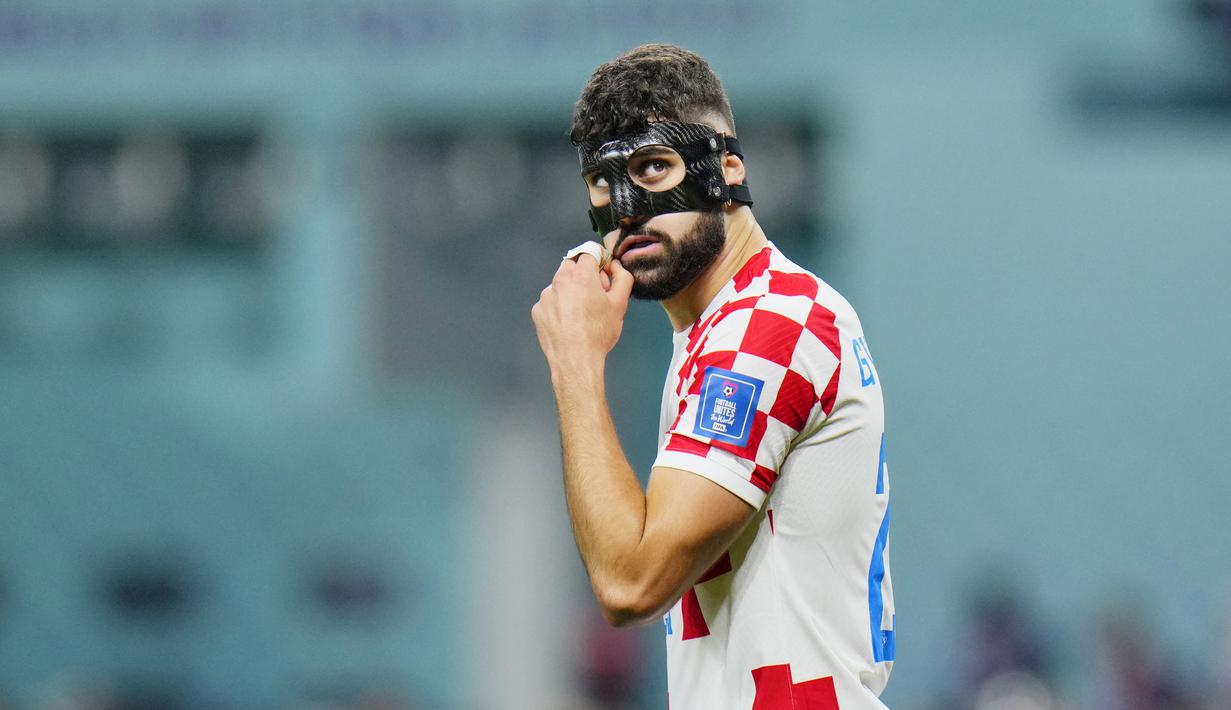 Bek berusia 20 tahun itu menjelma menjadi pemain bertahan yang kukuh sekaligus mengerikan bagi penyerang lawan. (AP Photo/Hassan Ammar)