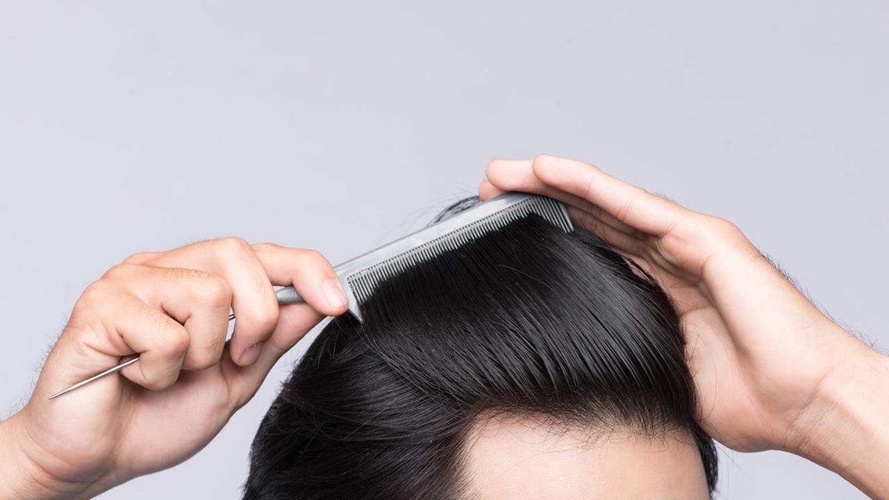 Rambut Menipis pada Pria, Apa Sih Penyebabnya? Waspadai Risiko Kebotakan, Temukan Solusinya!