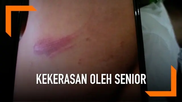 Seorang siswa madrasah di Ogan Ilir, Sumatera Selatan mengaku dianiaya oleh senior saat kegiatan pramuka. Tak terima, orangtua melaporkan kejadian ini ke polisi.