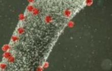 Heboh Virus Nipah, Kemenkes Ungkap Kondisi WNI di India
