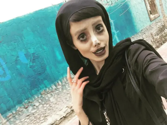 Gadis Iran Tempuh 50 Operasi Plastik Agar Mirip Angelina Jolie