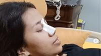 Mayang, adik Vanessa Angel (Foto: Instagram/@dodysoedrajat_1)